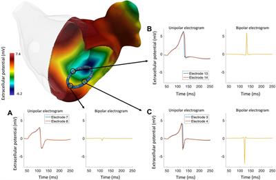 A Review of Healthy and Fibrotic Myocardium Microstructure Modeling and Corresponding Intracardiac Electrograms